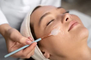 Best Age to Start Chemical Peels for Anti-Aging