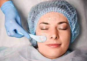 Chemical Peels for Sensitive Skin: Do’s and Don’ts