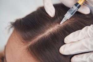 How Mesotherapy Works for Hair Regrowth?
