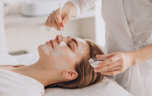 chemical peel