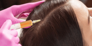 GFC Hair Treatment for Early Hair Thinning