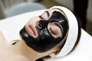 Does Carbon Laser Peel Reduce Blackheads?