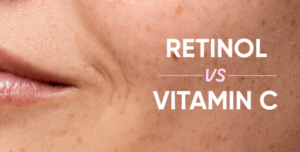 Vitamin C vs. Retinol for Dark Circles – Which Is More Effective?