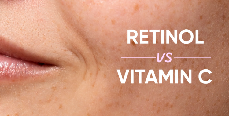 Vitamin C vs. Retinol