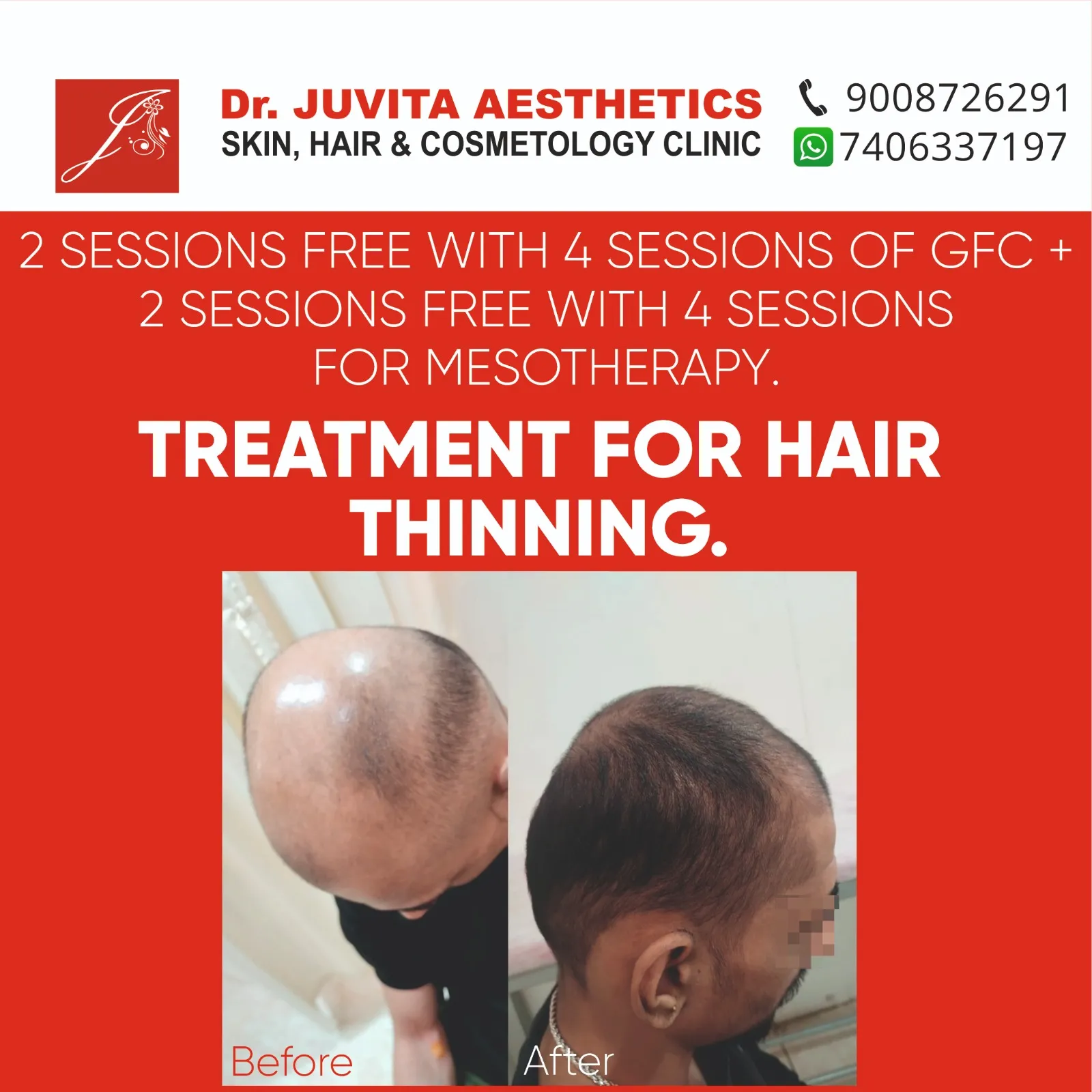 WhatsApp Image 2026-03-26 at 5.32.08 PM (3)